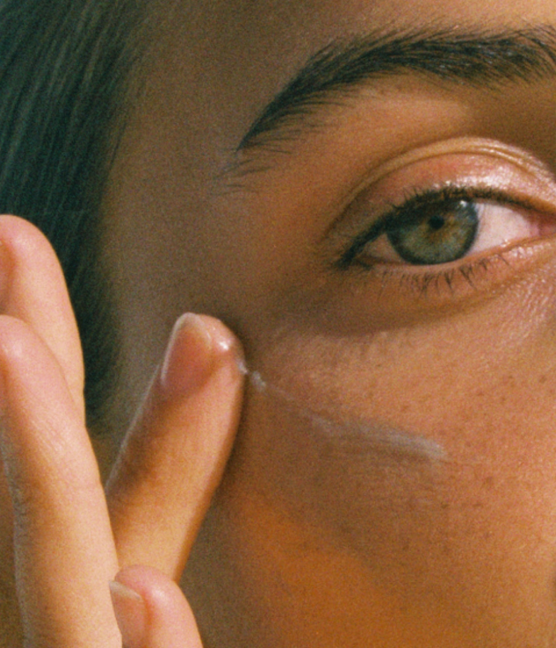 5 Things Your Skin Is Trying to Tell You About Your Health