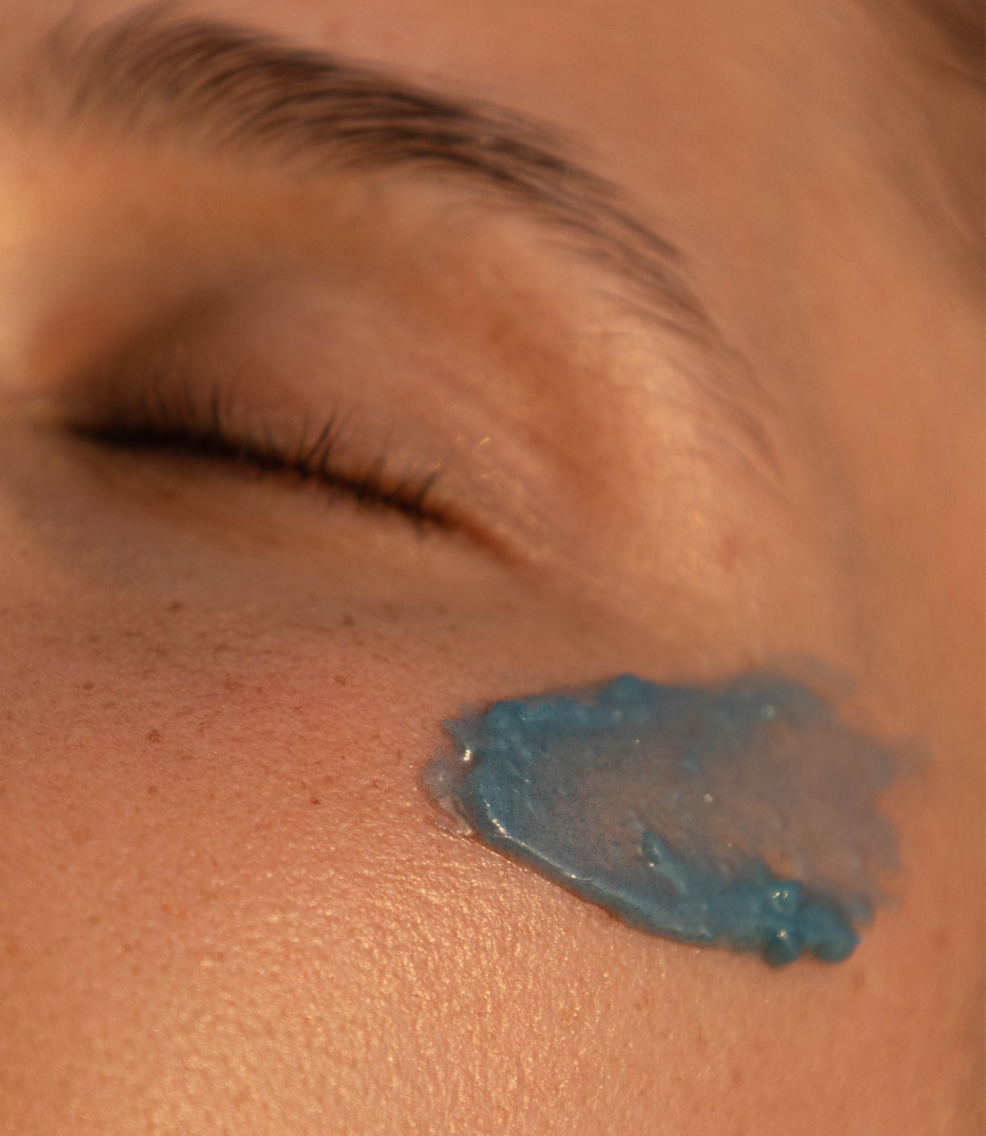 Post-Accutane Skincare Routine: Maintaining Your Skin