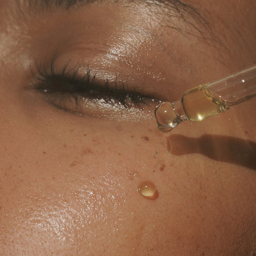 Olive Oil for Acne: 3 Amazing Benefits